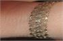 Bracelet View lV
